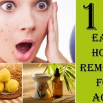 10 home remedies to get rid of pimples