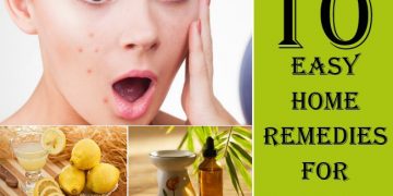 home remedies to get rid of pimples