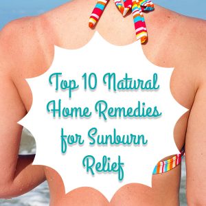 Top-10-Natural-Home-Remedies-for-Sunburn-Relief