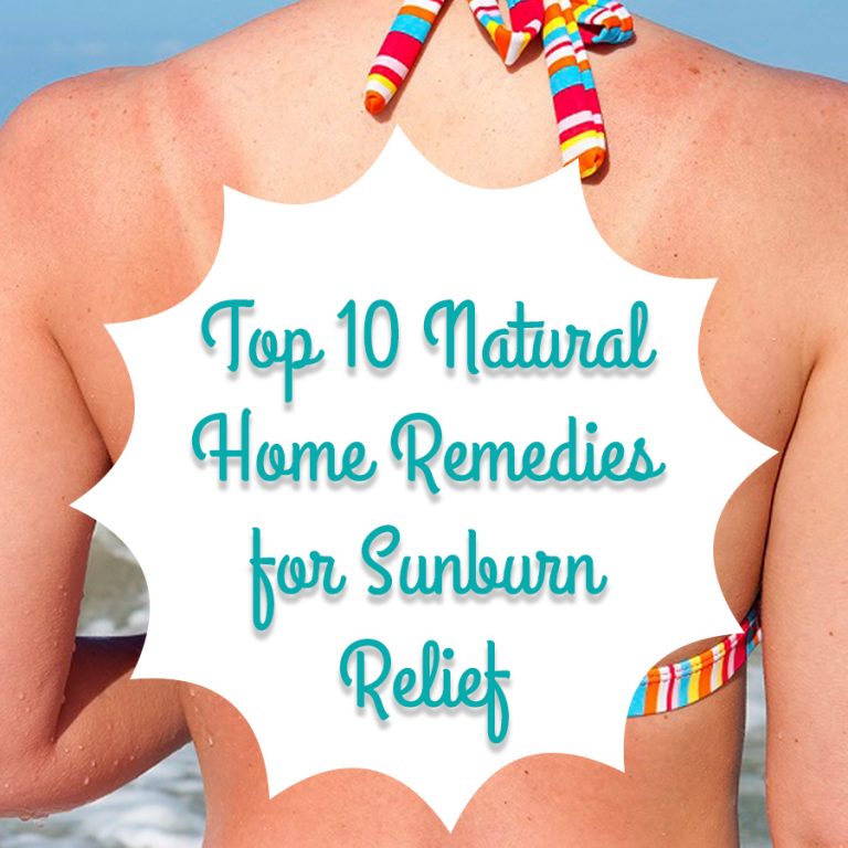 10 home remedies to treat sunburn  Bugg Times